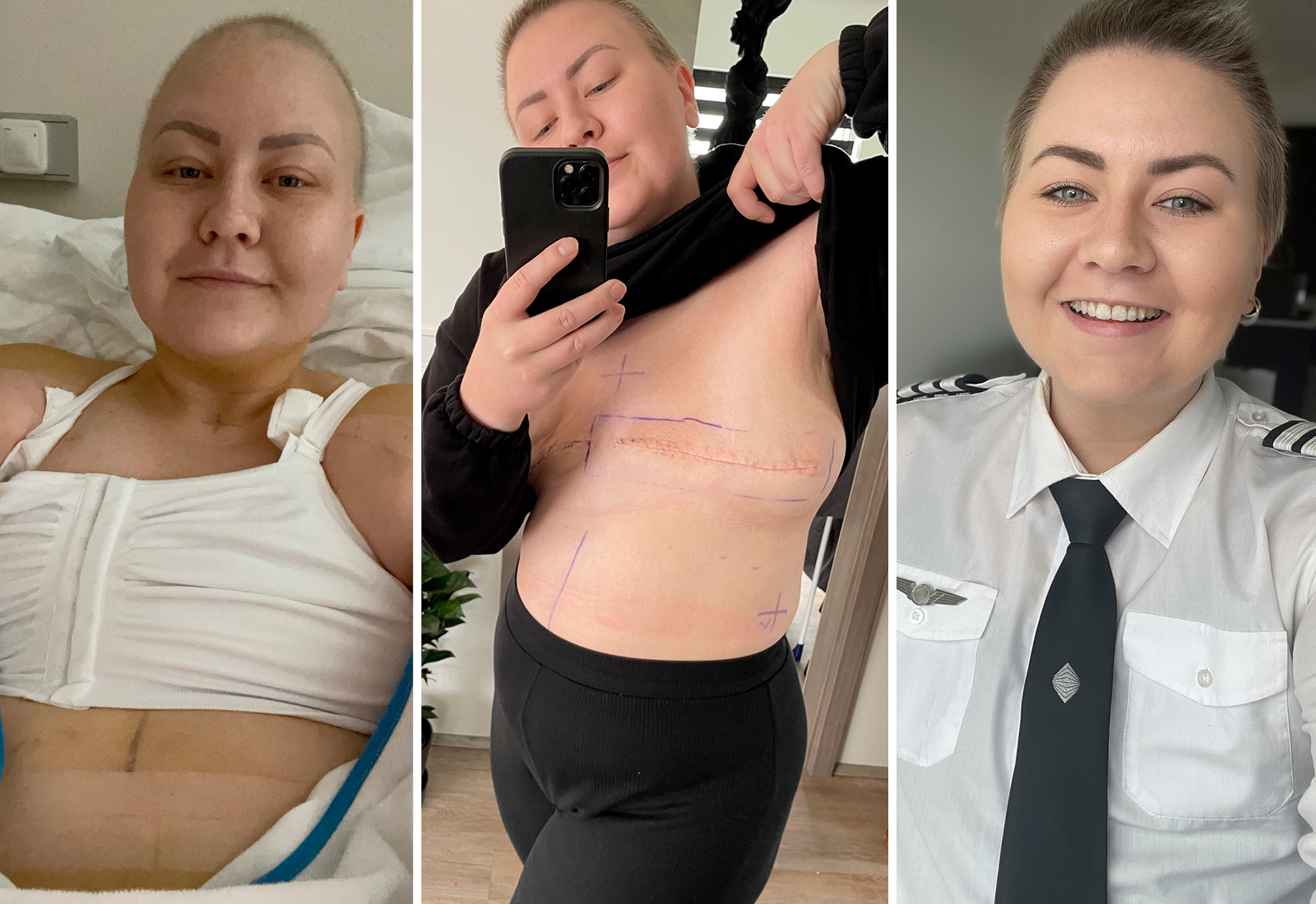 „Enn í dag að syrgja að ég er ekki með brjóst“